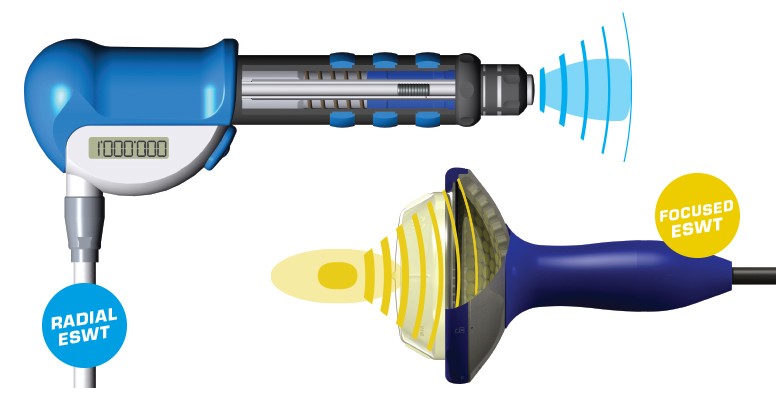 onde_durto_valdarno_istituto_palloni